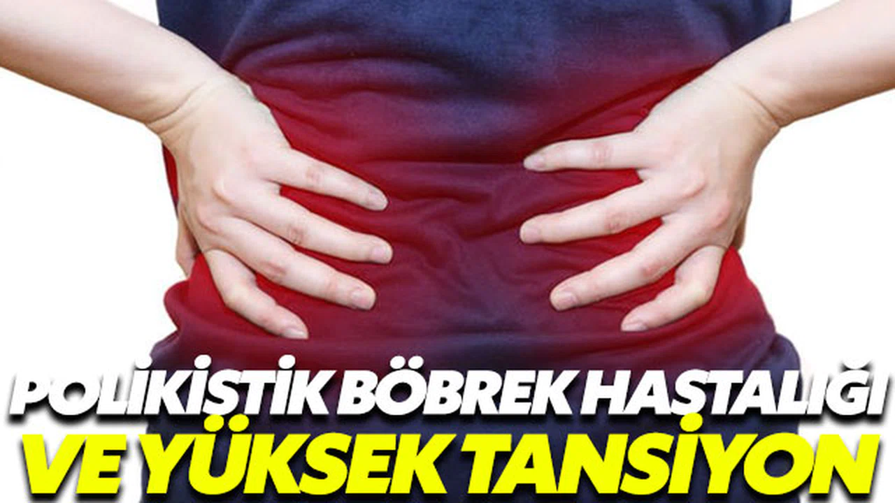 Polikistik böbrek hastalığı yüksek tansiyonla birlikte ilerliyor