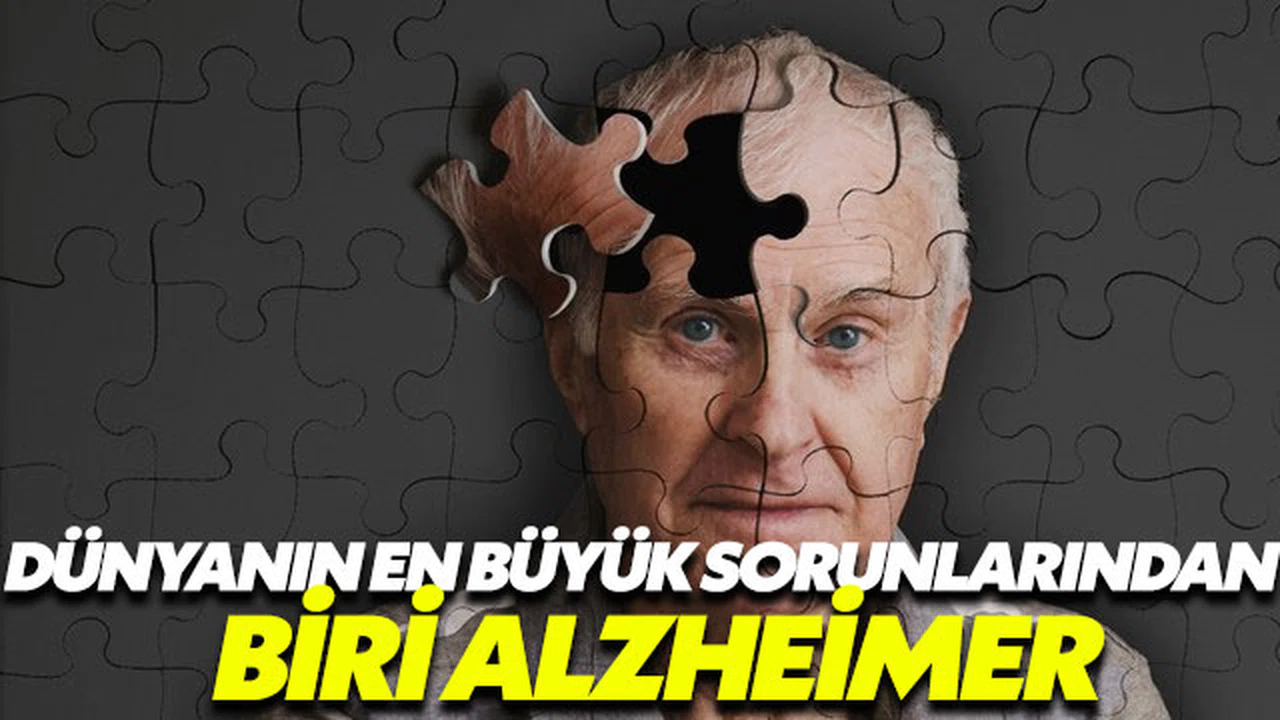 Alzheimer dünyanın en büyük sorunlarından biri haline geldi