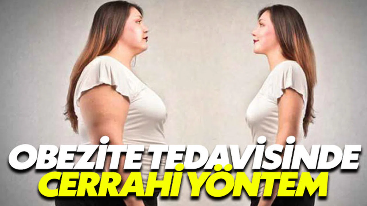 Obezite cerrahisinde hangi yöntemler uygulanıyor?