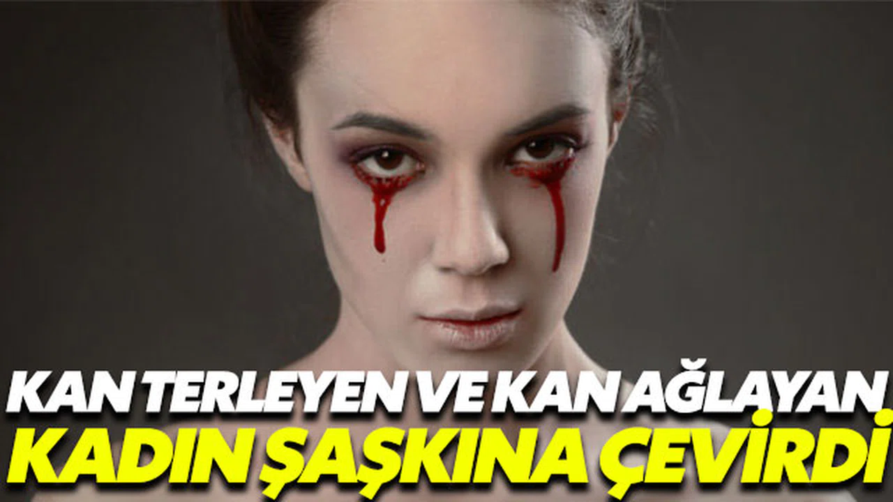 Kan terleyen ve kan ağlayan kadın şaşkına çevirdi