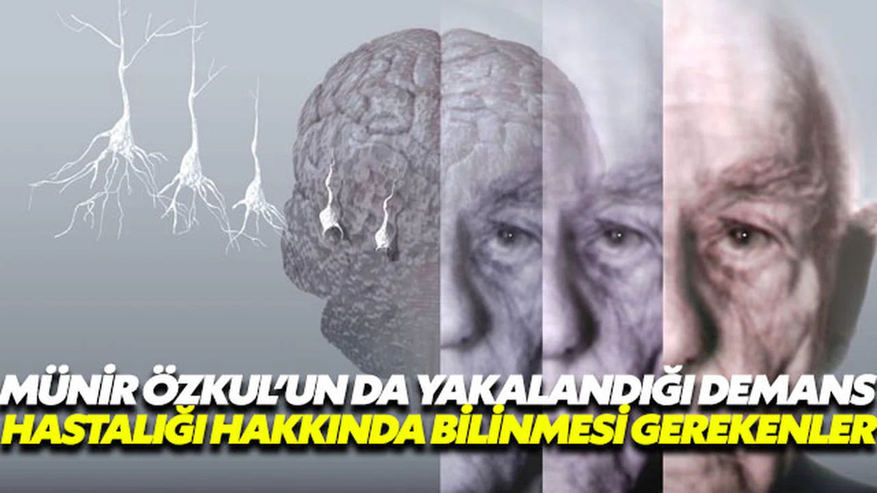 İşte Demans hastalığı ve bilinmesi gerekenler