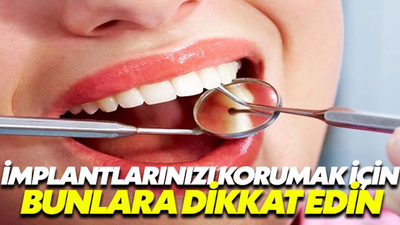 Bu noktalara dikkat etmezseniz implantlarınız en fazla 3 sene dayanır!