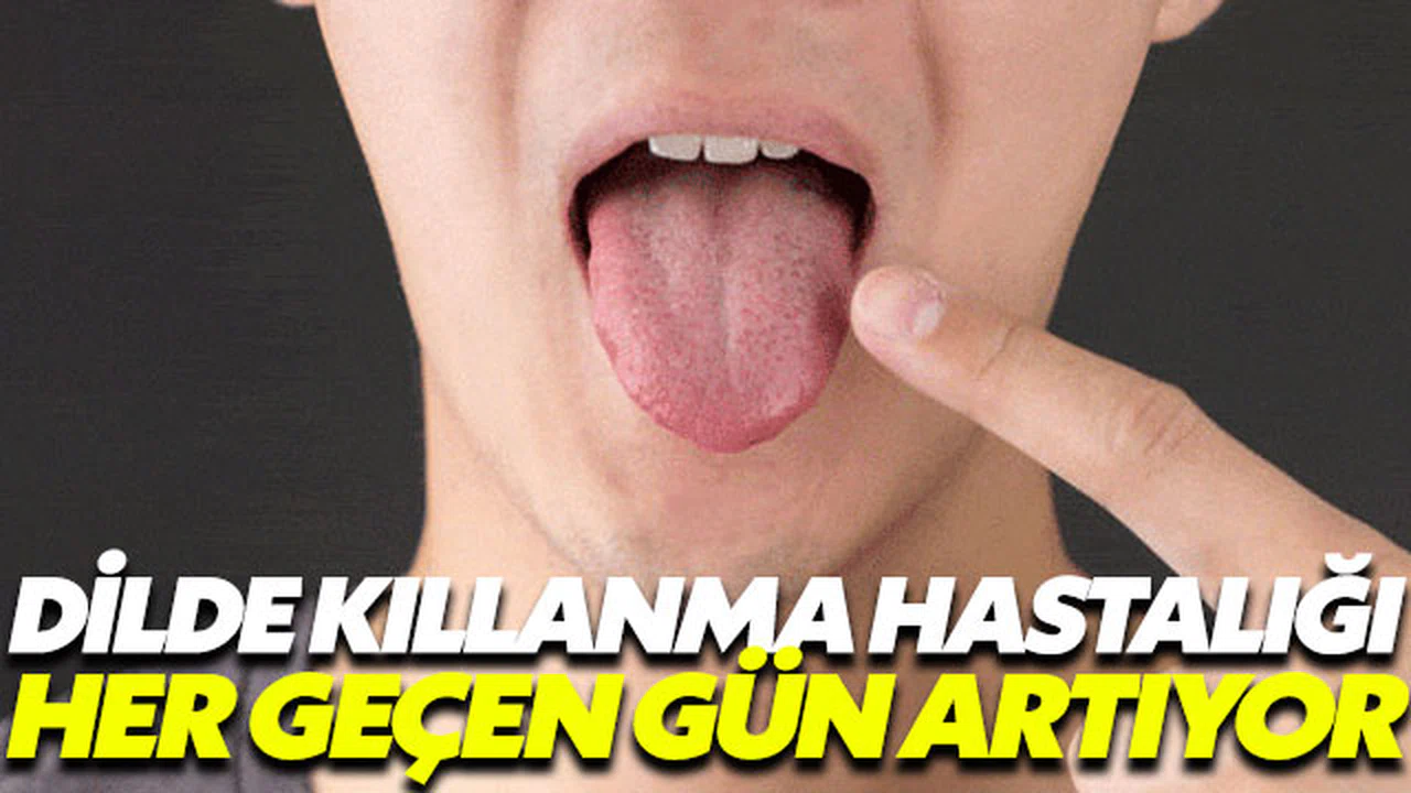 Dilde kıllanma hastalığı her geçen gün artıyor