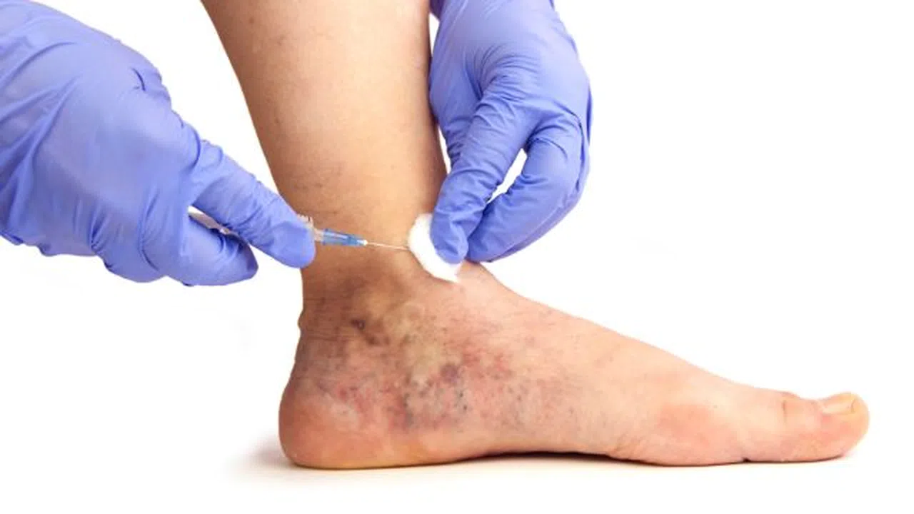 Varislerinizden kurtulmak istiyorsanız tam zamanı