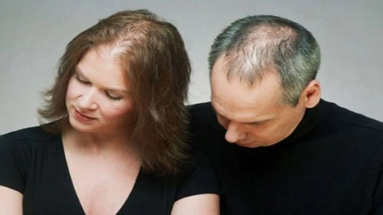 Saçlarınızın dökülmesini nasıl engelleyebilirsiniz