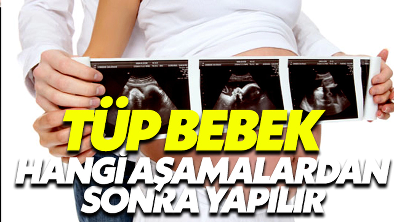 Tüp Bebek Hangi Aşamalardan Sonra Yapılır?