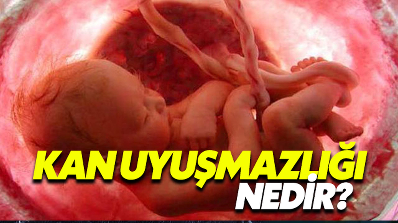 Kan Uyuşmazlığı Nedir?
