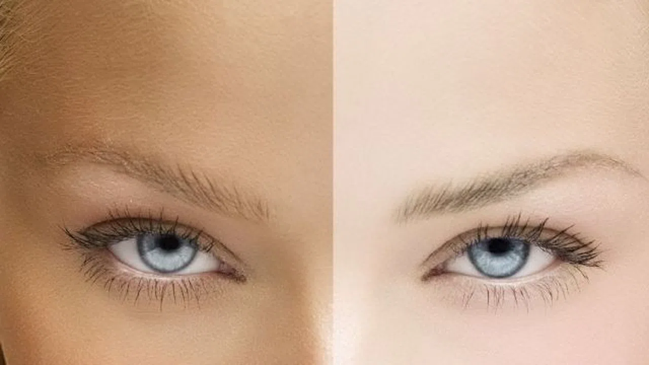 Doğal Yollarla Ten Rengi Açmak Mümkün Mü?