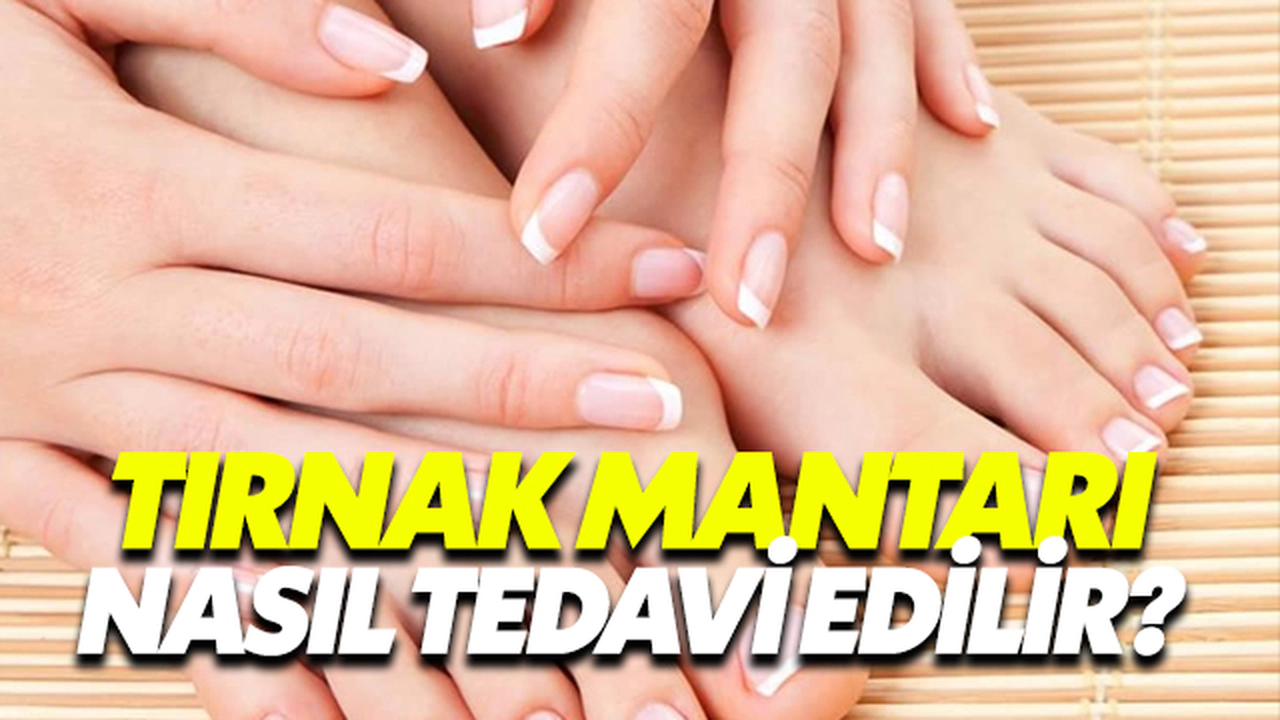 Tırnak Mantarı Nasıl Tedavi Edilir?