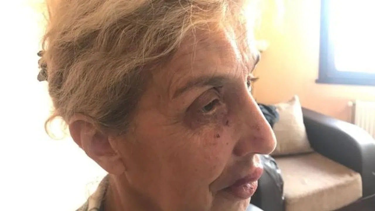 Sokak hayvanlarını beslerken kadınların saldırısına uğradı