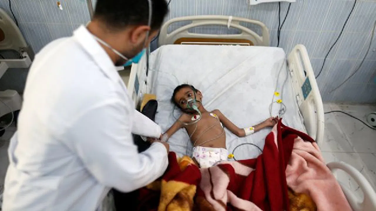 İnsanlık sınıfta kaldı; Yemen açlıkla pençeleşiyor