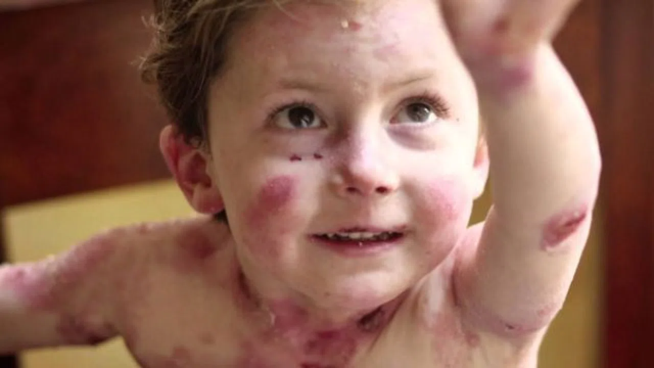 Haluk Levent Kelebek Hastası Elfida Gündüz'ü İzmir'de ziyaret etti