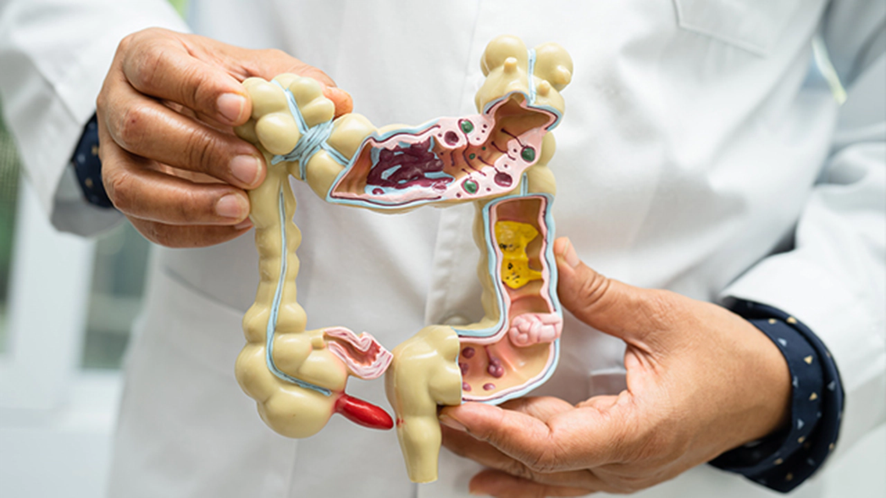 Bağırsak Sağlığını Desteklemek İçin Hangi Besinler Tüketilmeli?