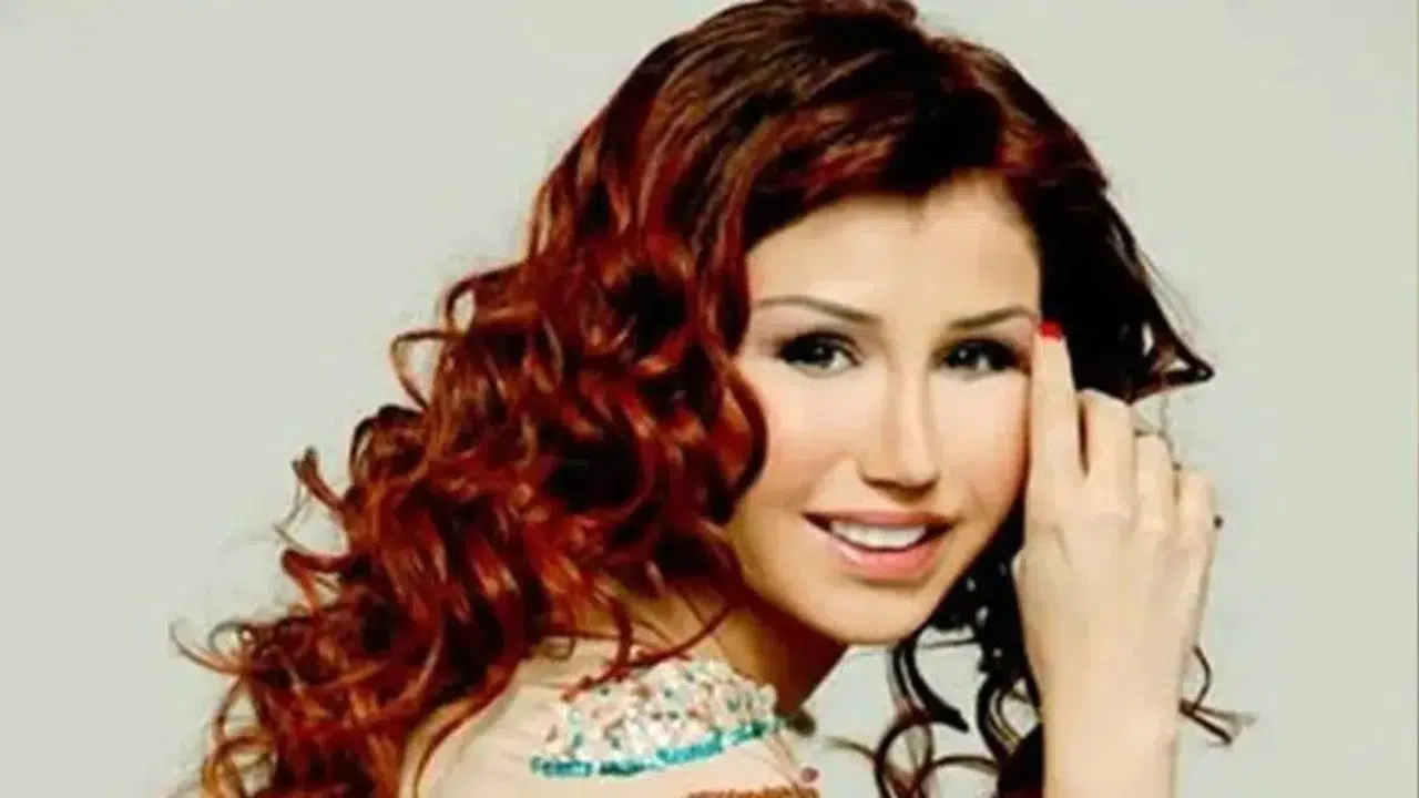 Şarkıcı Ceylan'ın Estetik Değişimi Gündem Olmaya Devam Ediyor