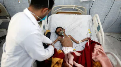 İnsanlık sınıfta kaldı; Yemen açlıkla pençeleşiyor