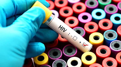 Türkiye'de AIDS'e yakalanan 10 kişiden 8'i erkek