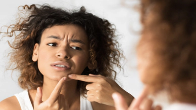 Siyah Noktalarla Başa Çıkmak: Cilt Bakımı İpuçları