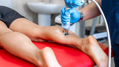 Varis Oluşumunun Sebepleri