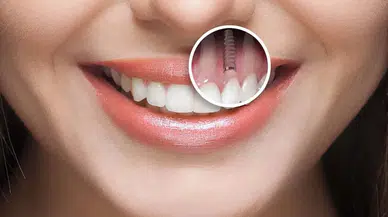 Vücudun Kendi Dişini Yapmasını Sağlayan İlaç İçin Geri Sayım Başladı