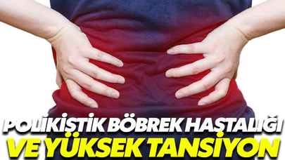 Polikistik böbrek hastalığı yüksek tansiyonla birlikte ilerliyor