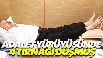 Adalet yürüyüşünde tırnakları düşmüş