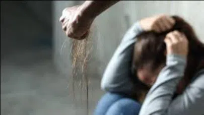 Tecavüz etmeye çalıştığı kadını kezzapla yaktı