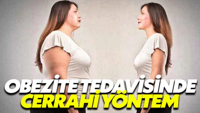 Obezite cerrahisinde hangi yöntemler uygulanıyor?