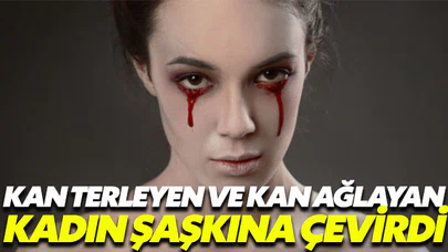 Kan terleyen ve kan ağlayan kadın şaşkına çevirdi