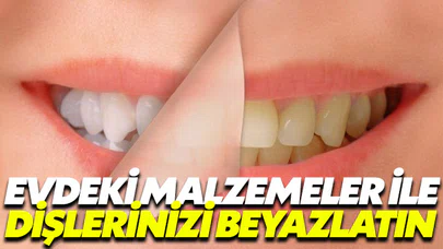 Evdeki malzemeler ile dişlerinizi beyazlatın