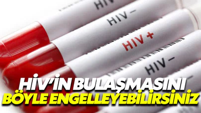 HIV’in bulaşmasını böyle engelleyebilirsiniz