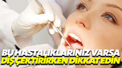 Bu hastalıkları olanlar diş çektirirken aman dikkat!