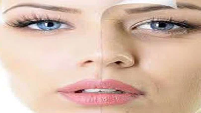 PRP yöntemi kendi kanınızla cildinizi yeniliyor