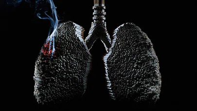 Kalp damar hastalıklarının büyük çoğunluğunda alkol ve sigara önemli rol oynuyor