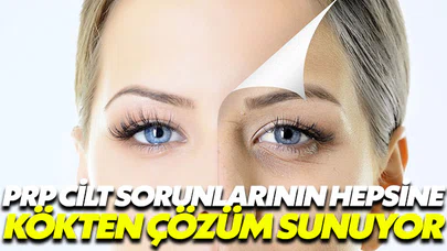 PRP cilt sorunlarının hepsine kökten çözüm sunuyor