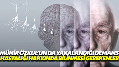 İşte Demans hastalığı ve bilinmesi gerekenler