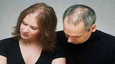 Saçlarınızın dökülmesini nasıl engelleyebilirsiniz