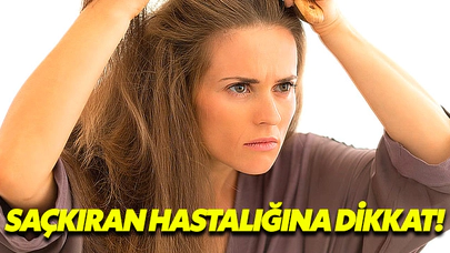 Saçkıran Hastalığına Dikkat!