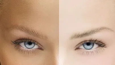 Doğal Yollarla Ten Rengi Açmak Mümkün Mü?