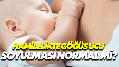 Hamilelikte Göğüs Ucu Soyulması Normal Mi?