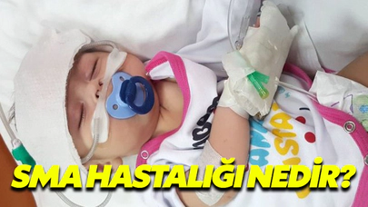 Sma Hastalığı Nedir?