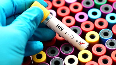 Türkiye'de AIDS'e yakalanan 10 kişiden 8'i erkek