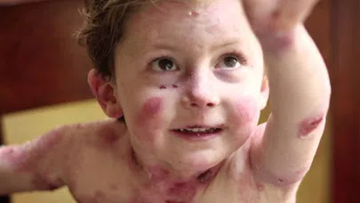 Haluk Levent Kelebek Hastası Elfida Gündüz'ü İzmir'de ziyaret etti