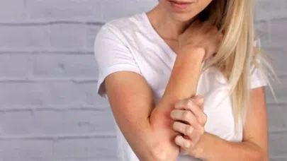 Uyuz hastalığına dikkat!