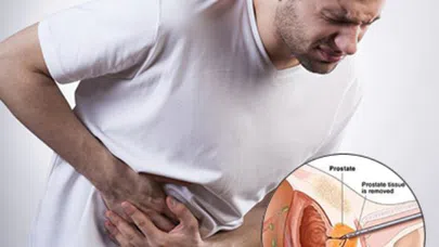 Prostat kanserinde erken teşhis kurtarır