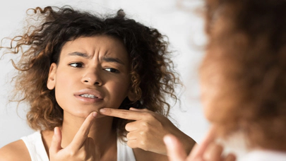 Siyah Noktalarla Başa Çıkmak: Cilt Bakımı İpuçları