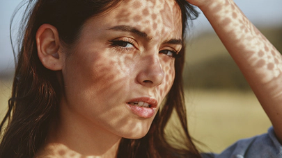 Güneş Lekeleri İçin Öneriler