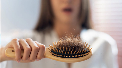 Saç Dökülmesini Önlemek İçin Nelere Dikkat Edilmeli?