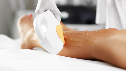 Epilasyon, Sağlık ve Güzellikte Etkili Bir Çözüm