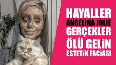 Görünce gözlerinize inanamayacaksınız... Genç kadın tanınmaz halde... 50 Ameliyat geçirdi...