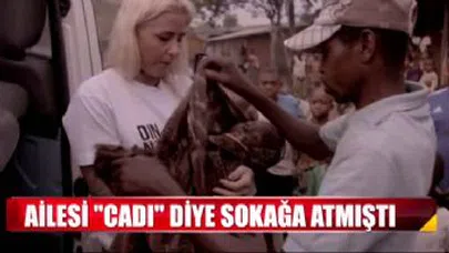 Ailesi cadı diye sokağa atmıştı...